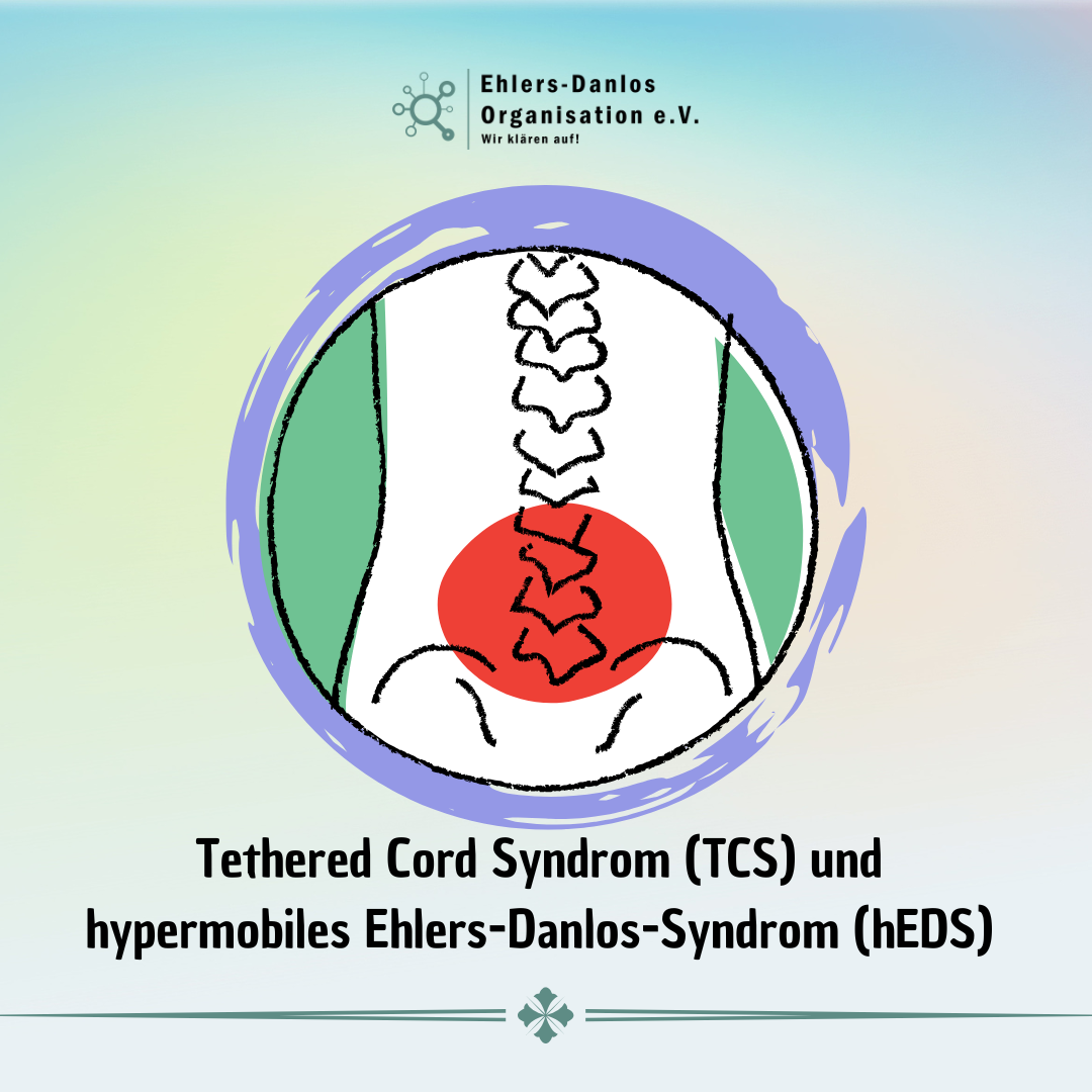 Tethered Cord Syndrom (TCS) und hypermobiles Ehlers-Danlos-Syndrom (hEDS)